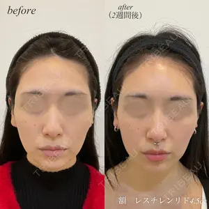DMTC美容皮膚科 日本橋院 松井泉医師の症例