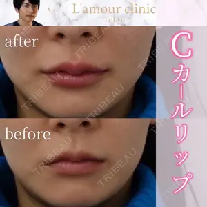 L‘amour clinic Tokyo【ラムールクリニック東京】の症例