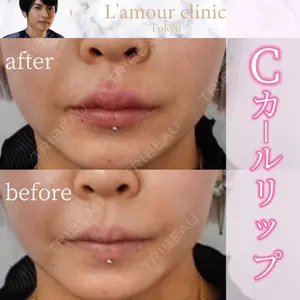 L‘amour clinic Tokyo【ラムールクリニック東京】の症例