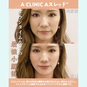 A CLINIC（エークリニック） 大阪院 田窪 賢志郎医師の症例