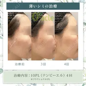 オラクル美容皮膚科 札幌院の症例