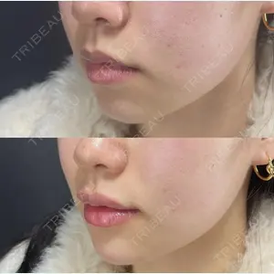 X CLINIC 銀座院 程 璐医師の症例
