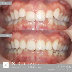 X CLINIC 銀座院 神田 純也医師の症例