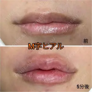 症例