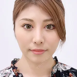 A CLINIC（エークリニック） 横浜院の症例