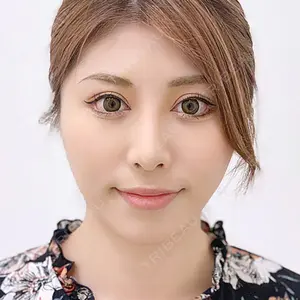 A CLINIC（エークリニック） 横浜院の症例