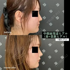 EMMO FACE CLINIC 大阪梅田院 山﨑 冴羅医師の症例