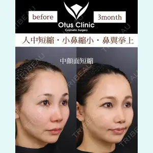 Otus Clinic 【オータスクリニック】 中 徳太郎医師の症例