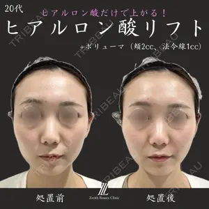 Zetith Beauty Clinic 福岡院 荻野 活医師の症例