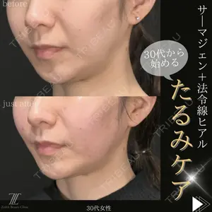 Zetith Beauty Clinic 福岡院 堂園 史子医師の症例