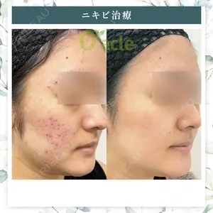オラクル美容皮膚科 名古屋院の症例