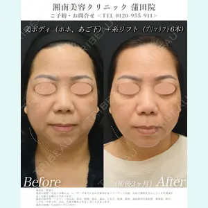 湘南美容クリニック 秋葉原院の症例