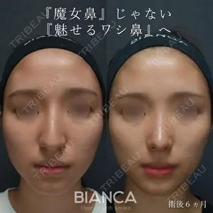 症例
