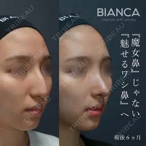 症例