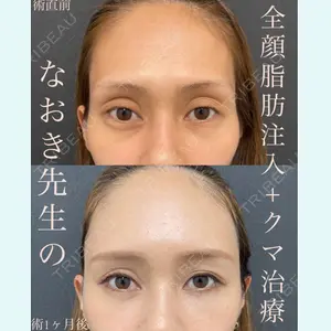 EMMO FACE CLINIC 大宮院 廣松 直樹医師の症例