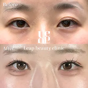 Leap beauty clinicの症例