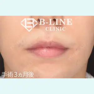 B-LINE CLINIC 池袋院 小池 康弘医師の症例