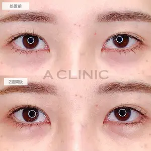 A CLINIC（エークリニック）横浜院 柴田 貴志医師の症例