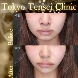 Tokyo Tensei Clinic 新宿院 辻 大成医師の症例