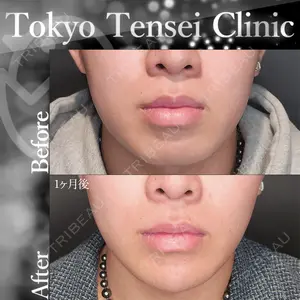 Tokyo Tensei Clinic 新宿院 沖津 勇気（ブレイブ沖津）医師の症例