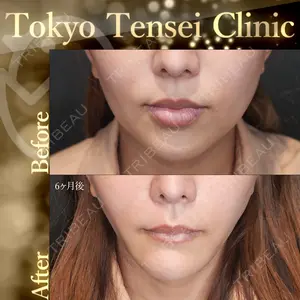 Tokyo Tensei Clinic 新宿院 辻 大成医師の症例