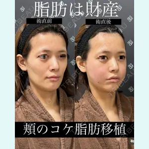 EMMO FACE CLINIC 大宮院 廣松 直樹医師の症例