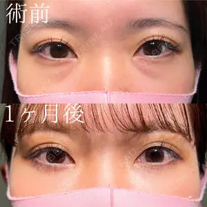 HAAB×DREAM BEAUTY CLINIC 大阪梅田院 鈴木 馨斗医師の症例