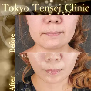 Tokyo Tensei Clinic 新宿院 辻 大成医師の症例