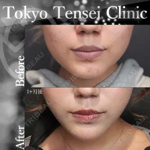 Tokyo Tensei Clinic 新宿院 沖津 勇気（ブレイブ沖津）医師の症例