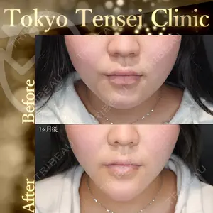 Tokyo Tensei Clinic 新宿院 辻 大成医師の症例