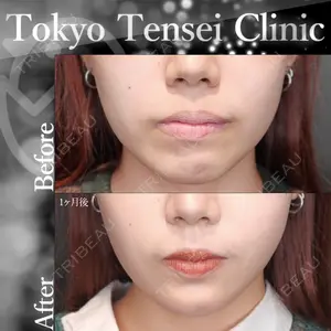 Tokyo Tensei Clinic 新宿院 沖津 勇気（ブレイブ沖津）医師の症例