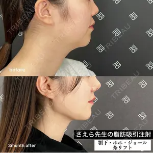 EMMO FACE CLINIC 大阪梅田院 山﨑 冴羅医師の症例