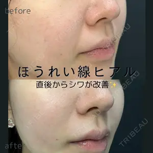 ルラ美容クリニック 仙台院 橋本 英樹医師の症例