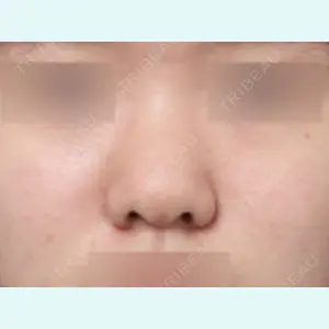 症例