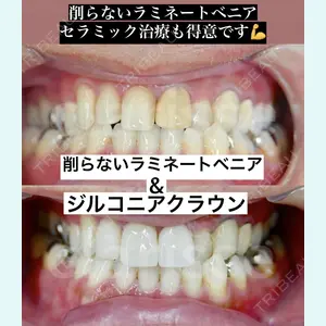 オーラルビューティークリニック クラリス審美歯科・矯正歯科 引野 貴之医師の症例
