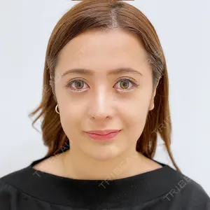 A CLINIC（エークリニック） 横浜院の症例