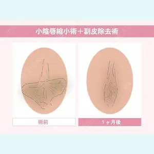 症例