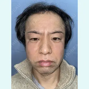 アルモ形成クリニック 内田 直宏医師の症例