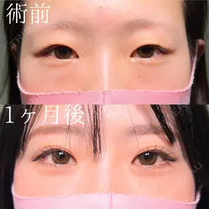 HAAB×DREAM BEAUTY CLINIC 大阪梅田院 鈴木 馨斗医師の症例