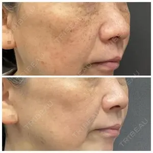 ゆきスキンクリニック 東池袋 小林 智之医師の症例