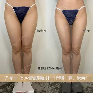 GAYA body design clinic 飯ヶ谷 重来医師の症例