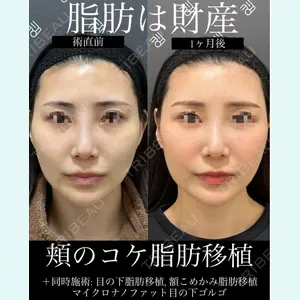 EMMO FACE CLINIC 大宮院 廣松 直樹医師の症例