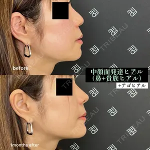 EMMO FACE CLINIC 大阪梅田院 山﨑 冴羅医師の症例