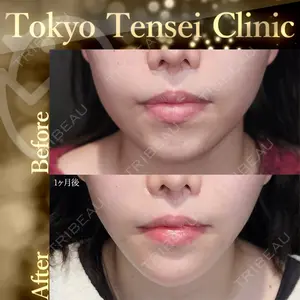 Tokyo Tensei Clinic 新宿院 辻 大成医師の症例