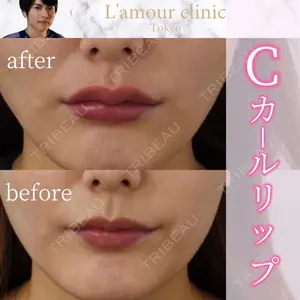 L‘amour clinic Tokyo【ラムールクリニック東京】の症例