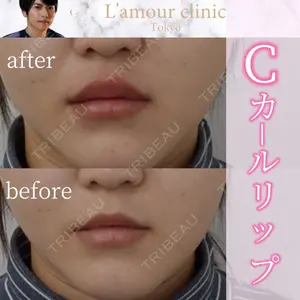 L‘amour clinic Tokyo【ラムールクリニック東京】の症例