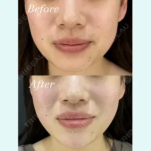 HAAB BEAUTY CLINIC 名古屋院 丸山 舜大医師の症例