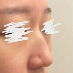 症例