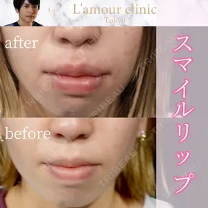 L‘amour clinic Tokyo【ラムールクリニック東京】の症例