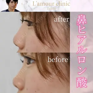 L‘amour clinic Tokyo【ラムールクリニック東京】の症例